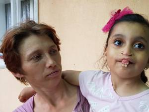 Alina și Narcisa, înainte de operație