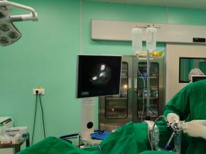 Interventia laparoscopica pentru eliminarea pietrelor la rinichi