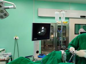 Intervenția laparoscopică pentru eliminarea pietrelor la rinichi