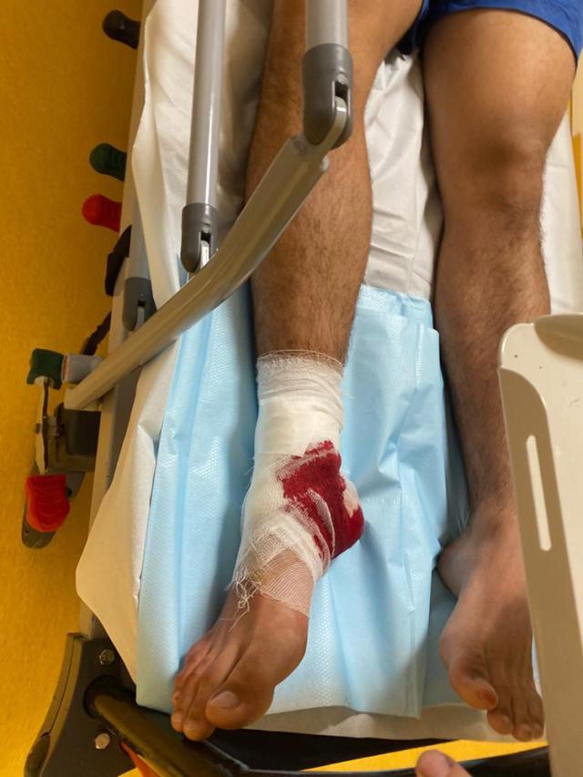 Încă un tânăr accidentat după ce a alunecat pe gresia udă la ștrandul de la Ițcani