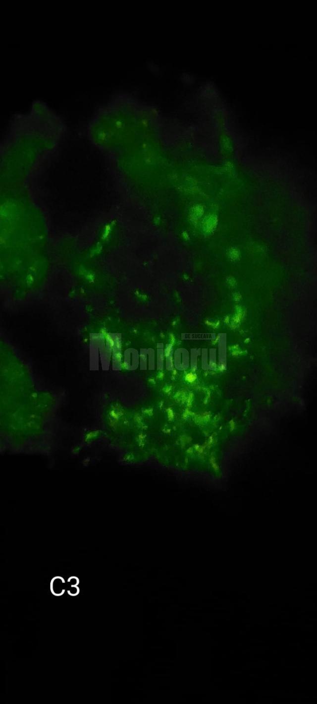 Imunoflorescenţa ce relevă depunere de C3 la nivelul capilarelor glomerulare