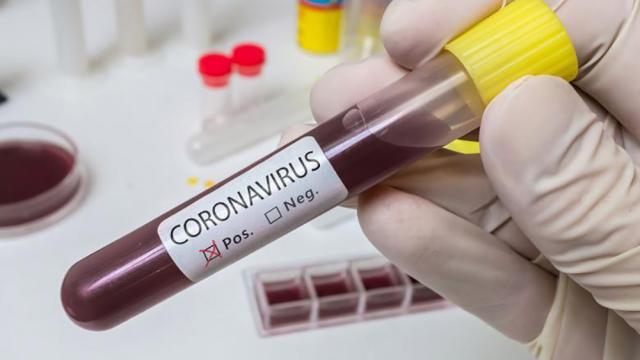 Spitalul de Urgență Suceava a crescut numărul paturilor pentru bolnavii de Covid-19, ca urmare a creșterii numărului de pacienți infectați cu SARS-CoV-2