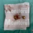 Suceveanul împușcat de polițiști la Botoșani, stabilizat, dar cu leziuni grave, care îi ...