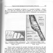 Fortificaţia de la Hliniţa (regiunea Cernăuţi, Ucraina, ridicare topografică de Karl A. Romstorfer, publicată în 1895)